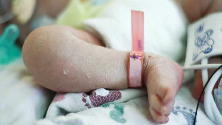 Bebé que nació con anticuerpos contra el COVID-19.
